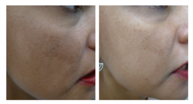 Skin maintenance 1