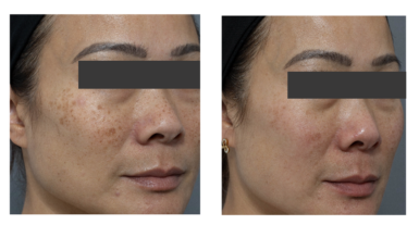 Skin maintenance
