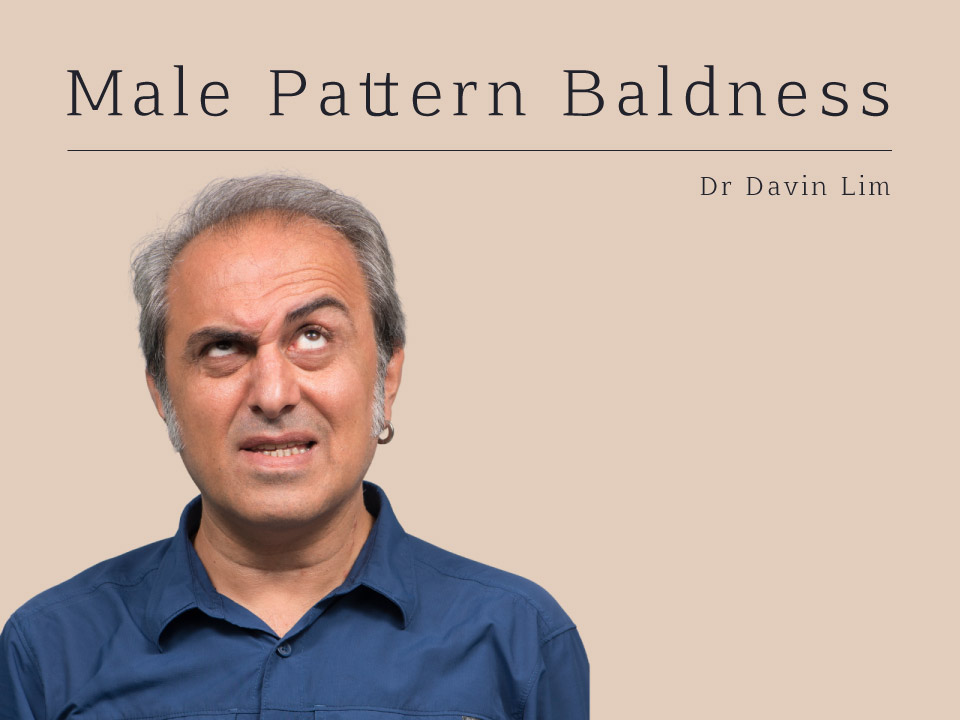 Male Pattern Baldness Dr Davin Lim Brisbane