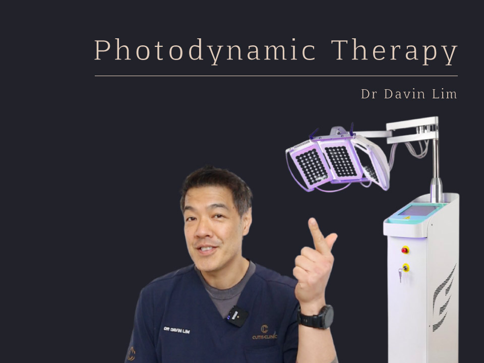 Photodynamic Therapy Skin Check Dr Davin Lim Brisbane