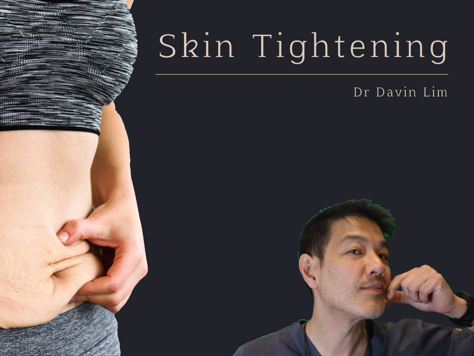 Skin Tightening Dr Davin Lim