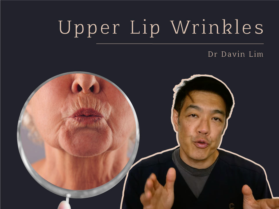 Treating Upper Lip Wrinkles and Smokers Lines Dr Davin Lim