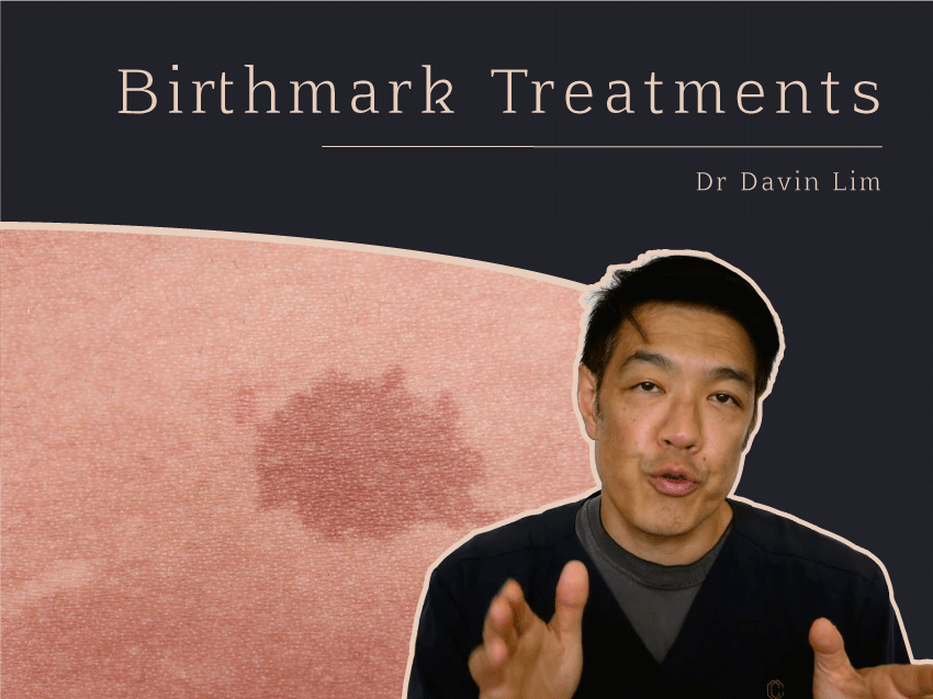 Birthmark Treatments Brisbane Dr Davin Lim