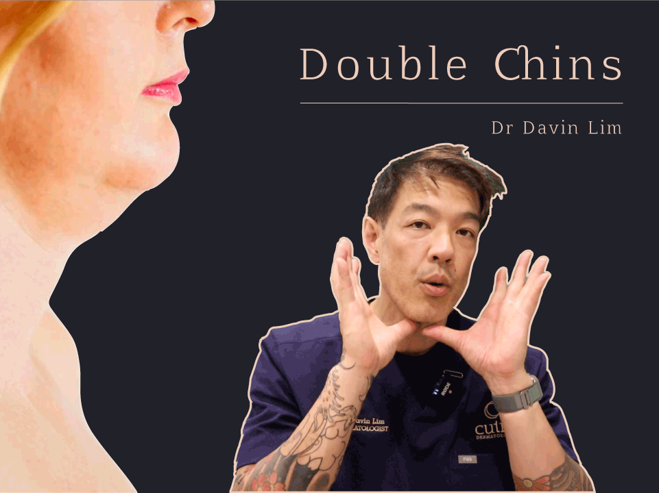 Double chin treatments dr davin lim brisbane
