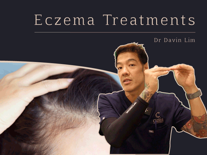 Eczema treatment brisbane Dr Davin Lim
