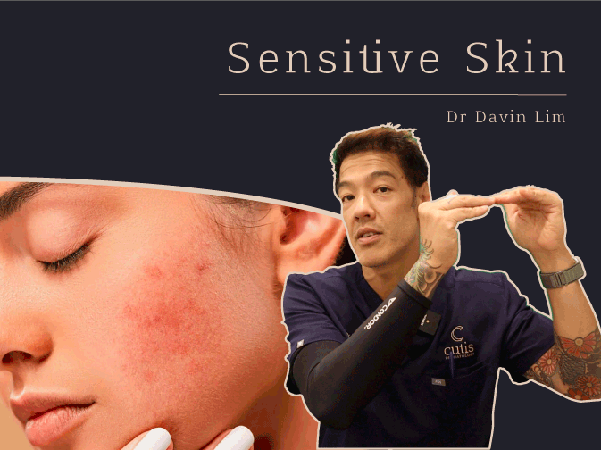 Sensitive skin treatments Dr Davin Lim