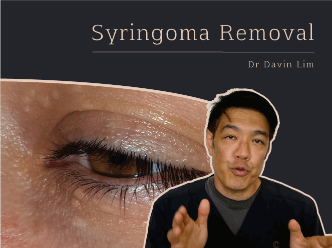 Syringoma removal eyes dr Davin Lim Brisbane