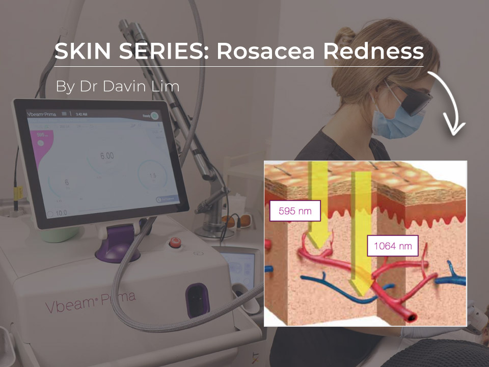 rosacea redness treatment cutis dermatology