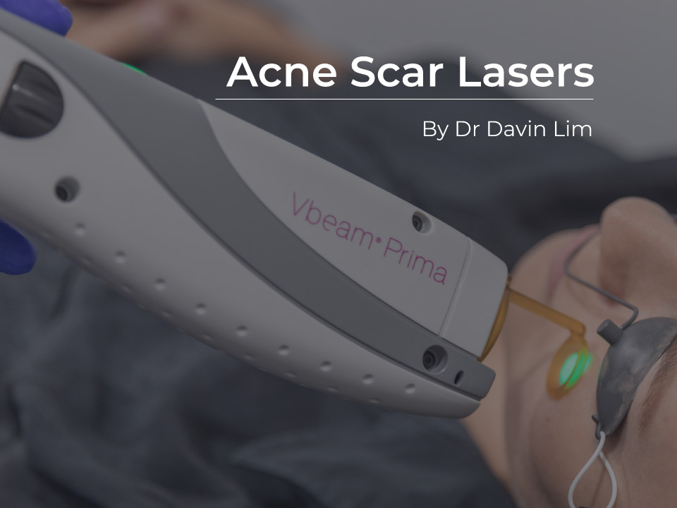 vascular lasers red acne scars