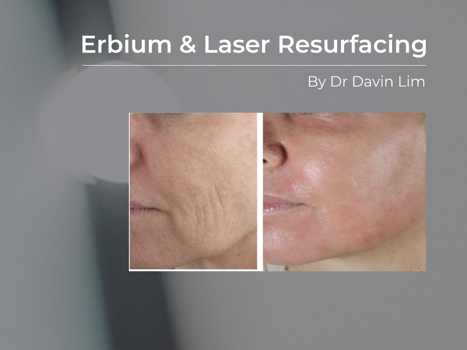 erbium laser resurfacing davin lim