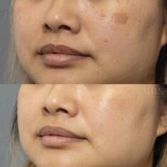 pico for pigment on cheeks