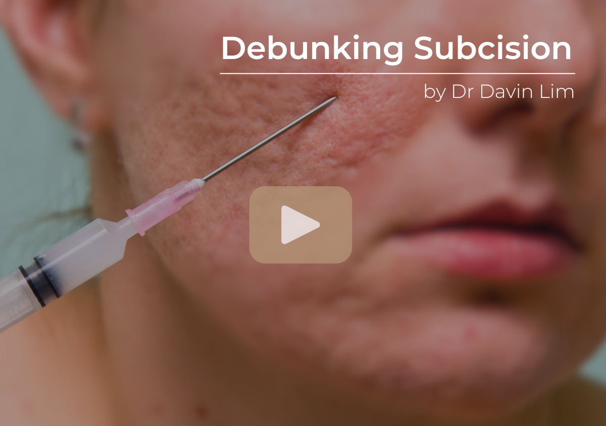 Subcision Debunked by a dermatologist