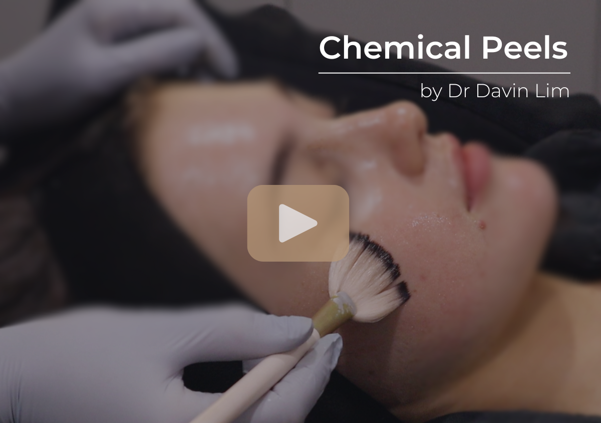 Chemical peels explained by a dermatologist