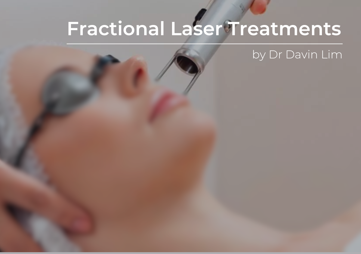 Fraxel Lasers for Acne Scars