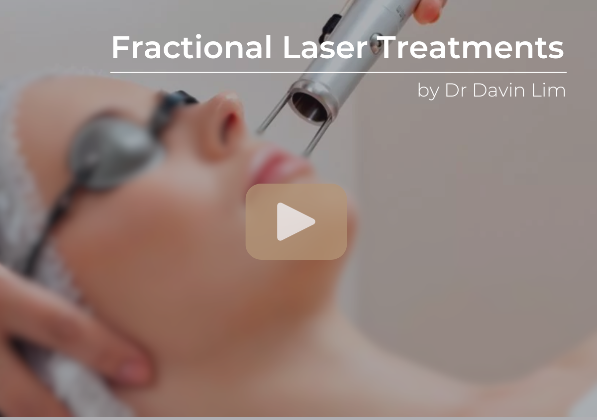 Fraxel Lasers for Acne Scars