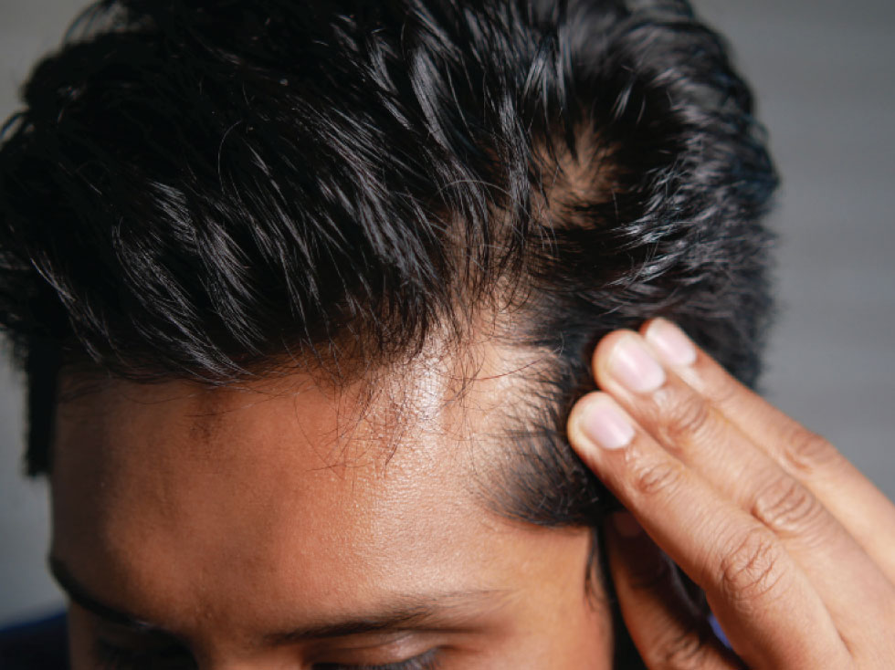 hair loss clinic brisbane