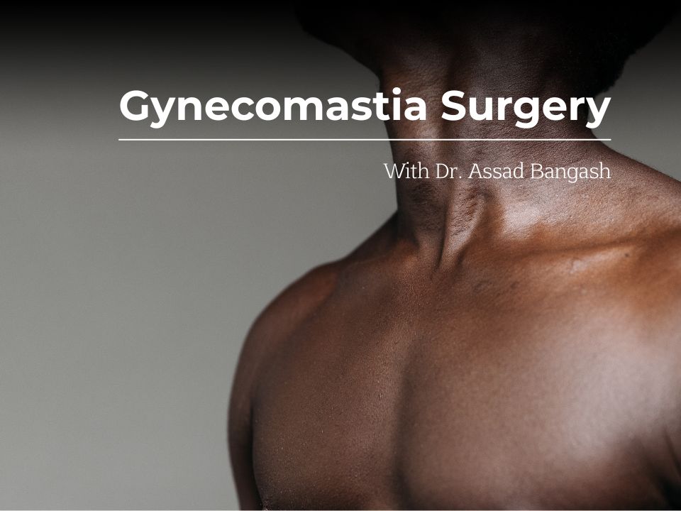 male breast reduction surgery brisbaner