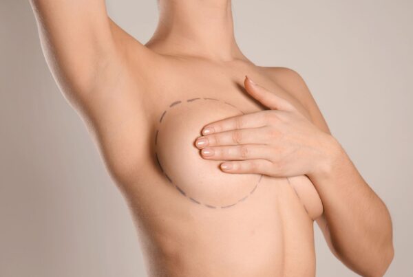 mammoplasty brisbane
