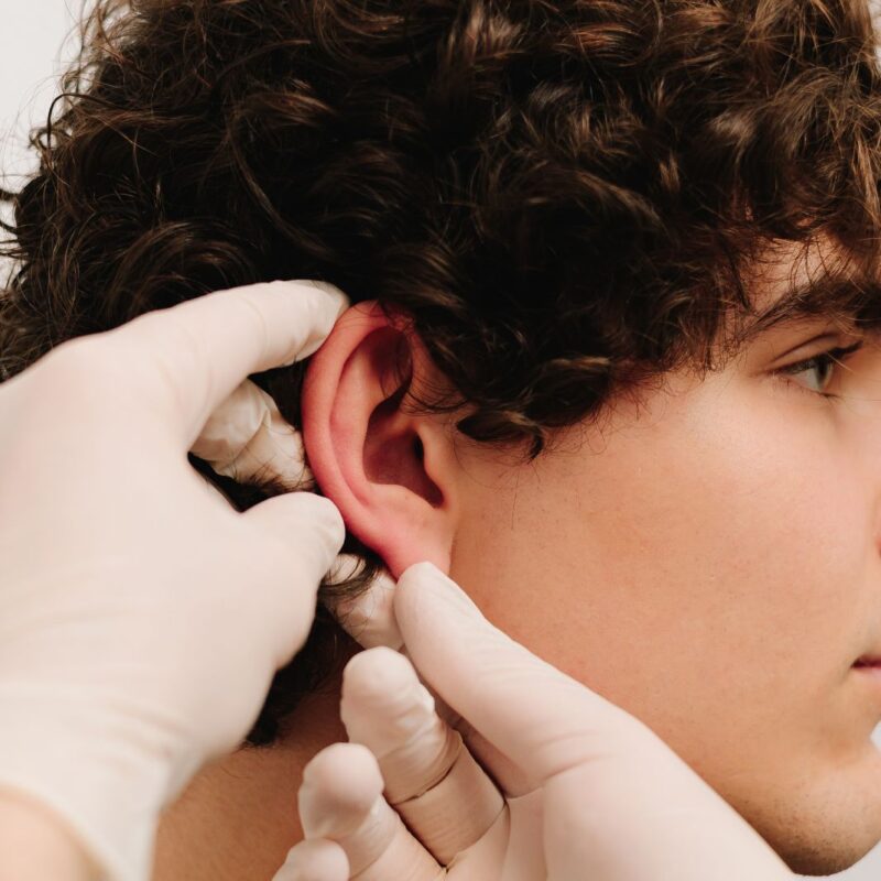 earlobe surgery