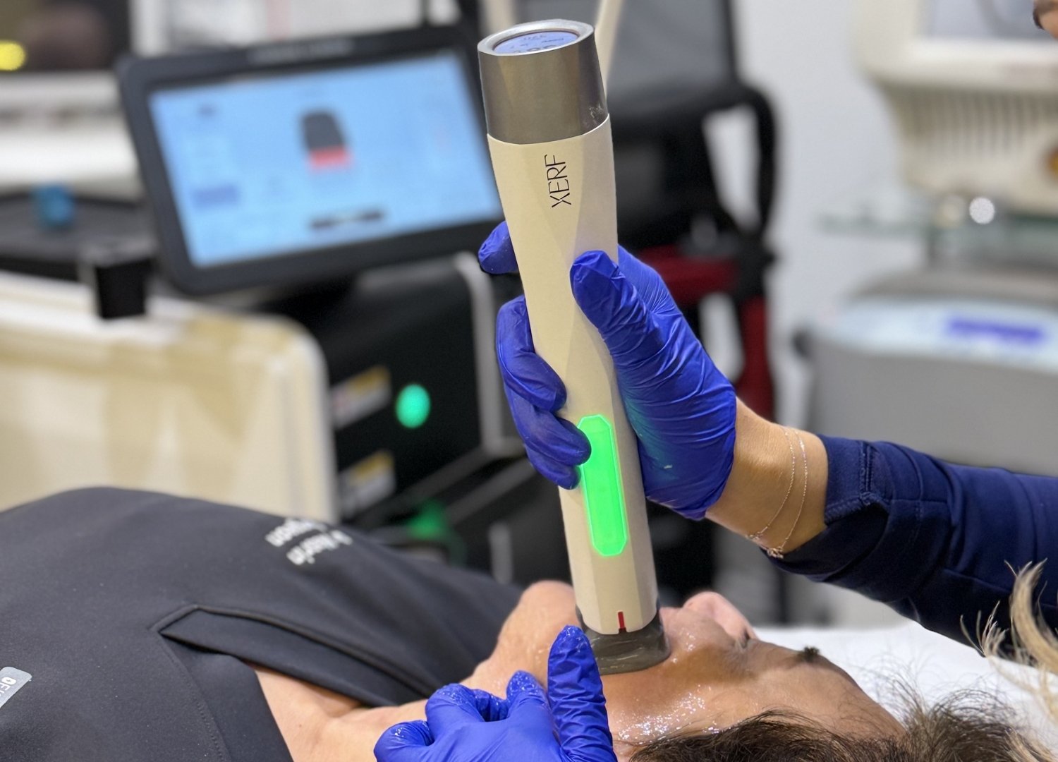 xerf vs ultherapy